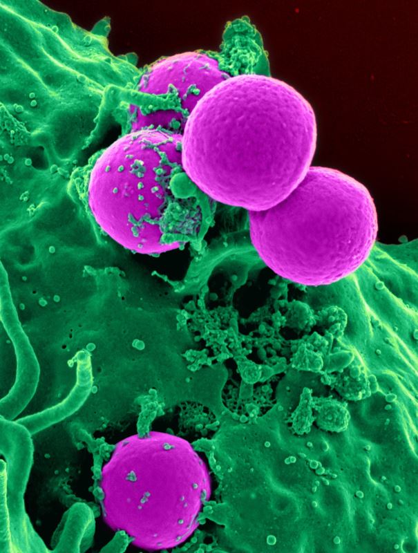美科學家研發能阻斷 前列腺癌細胞生長的成分 