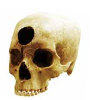 古祕魯人技術了得 頭顱穿孔存活率高達8成