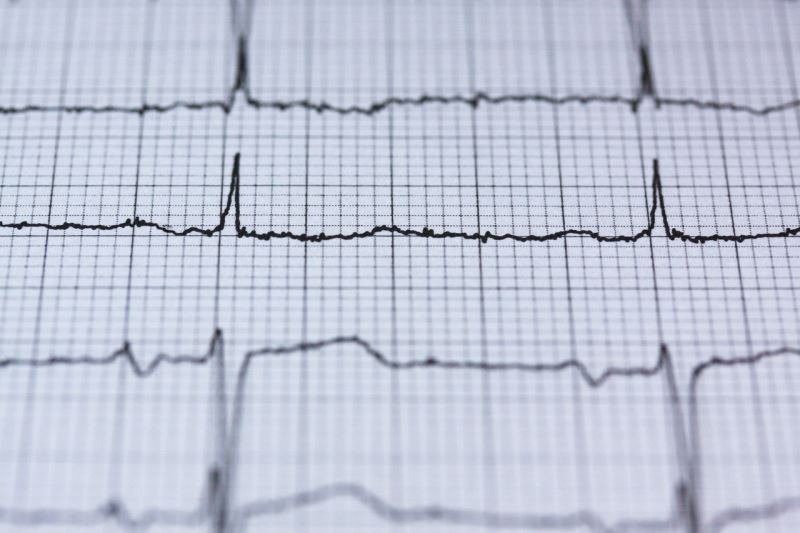 心臟微弱的生理訊號－利用心電圖辨識身分