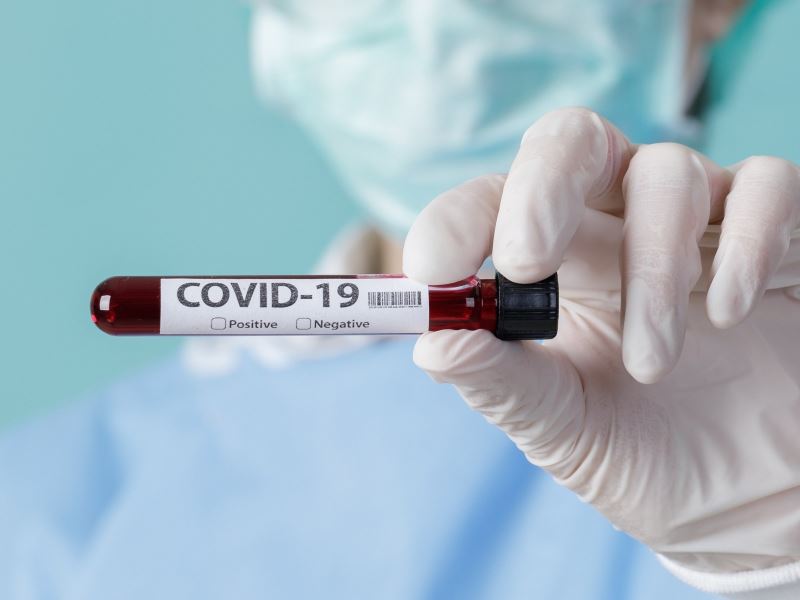 「COVID-19宿主遺傳學計畫」發現與長新冠相關的基因
