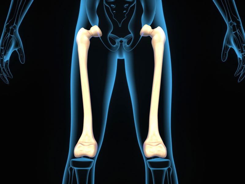 新的仿生材料製造技術 有望修復人體股骨骨折
